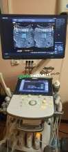 Canon Aplio i800 Ultrasound