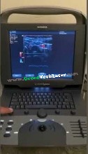 Acuson Cypress PLUS Ultrasound