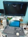 Mindray Resona 6 Diagnostic Ultrasound