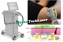 miraDry Sweat Reduction