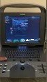 Acuson Cypress PLUS Ultrasound
