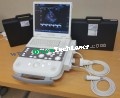 SIEMENS ACUSON P300 ULTRASOUND SYSTEM