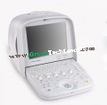 Siui Ultrasound Scanner CTS7700 Plus – SIUCTS7700