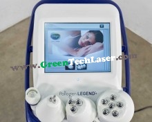 LUMENIS POLLOGEN LEGEND PRO