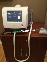 Viveve Model S www.GreenTechLaser.com