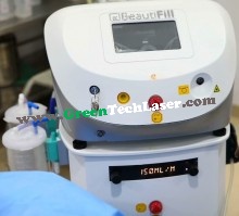 Alma BeautiFill Liposuction Skin Tightening