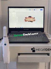 Medit i500 Intraoral Scanner