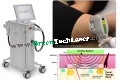 miraDry Sweat Reduction