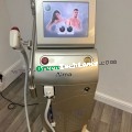 Alma Soprano ICE Laser Hair Removal
